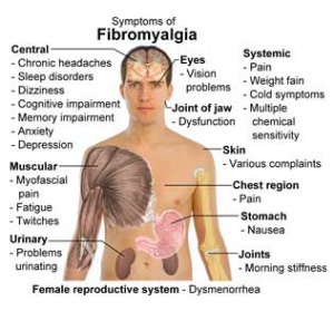 Fibromyalgia Points Tenderness Chart