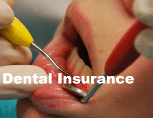 Close-up of dental examination with tools in a patient's mouth.